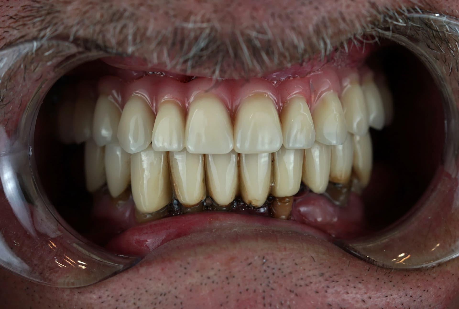 Image two