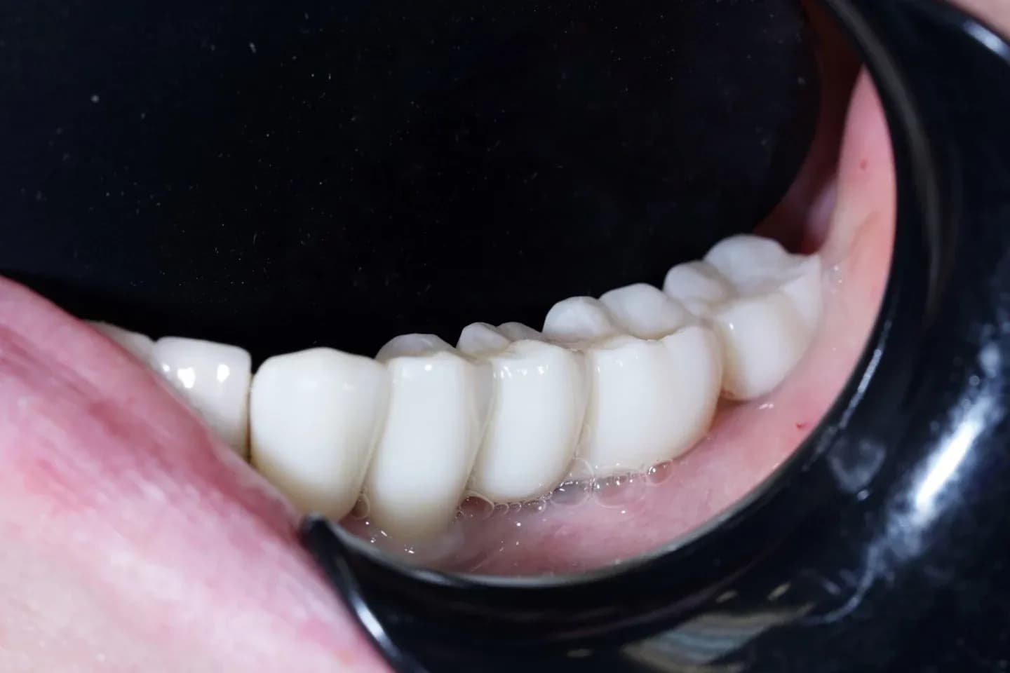 Image two