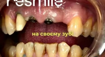 video preview Кейсы
